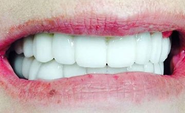 smile 10