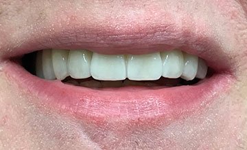 smile 6