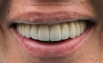 smile 4