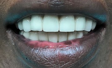 smile 2