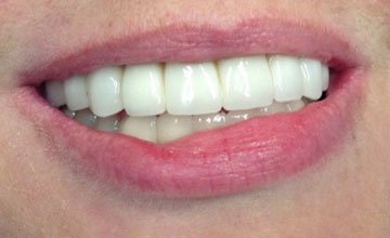 smile 3